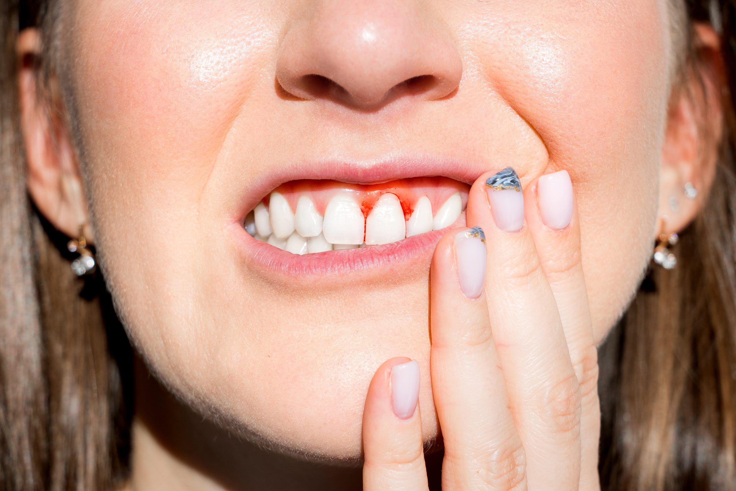 How To Alleviate Gum Pain